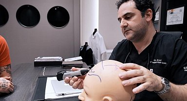 Dr. Levent Acar: "Türkiye saç ekiminde zirvede"